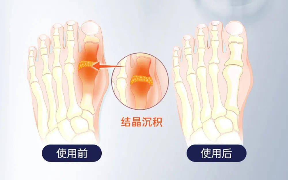 蛋白粉能和硒一块儿补吗(蛋白能补粉儿硒嘛)-硒宝网