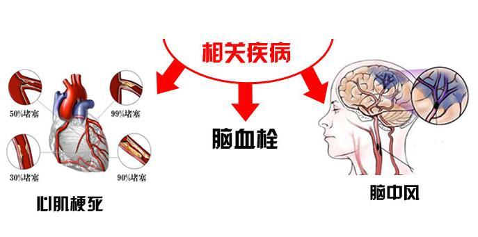 富硒荞子茶对脑血管好吗（富硒荞子茶对脑血管好吗）-硒宝网