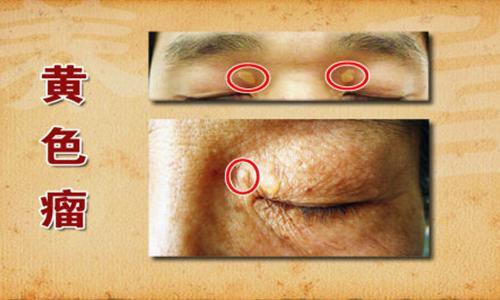 富硒荞子茶对脑血管好吗（富硒荞子茶对脑血管好吗）-硒宝网