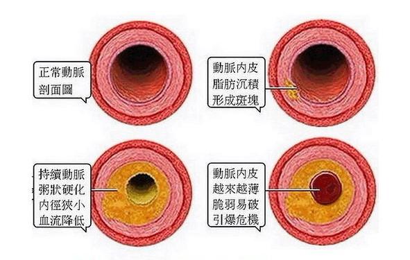 富硒荞子茶对脑血管好吗（富硒荞子茶对脑血管好吗）-硒宝网