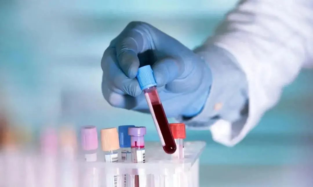 富硒茶和决明子可以一起（茶加决明子）-硒宝网