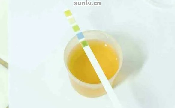 喝富硒茶尿黄怎么回事儿（喝茶水和尿黄有关系么）-硒宝网