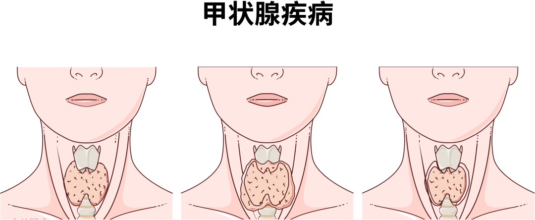 甲状腺吃富硒蔬菜好吗吗(甲状腺富硒食品)-硒宝网