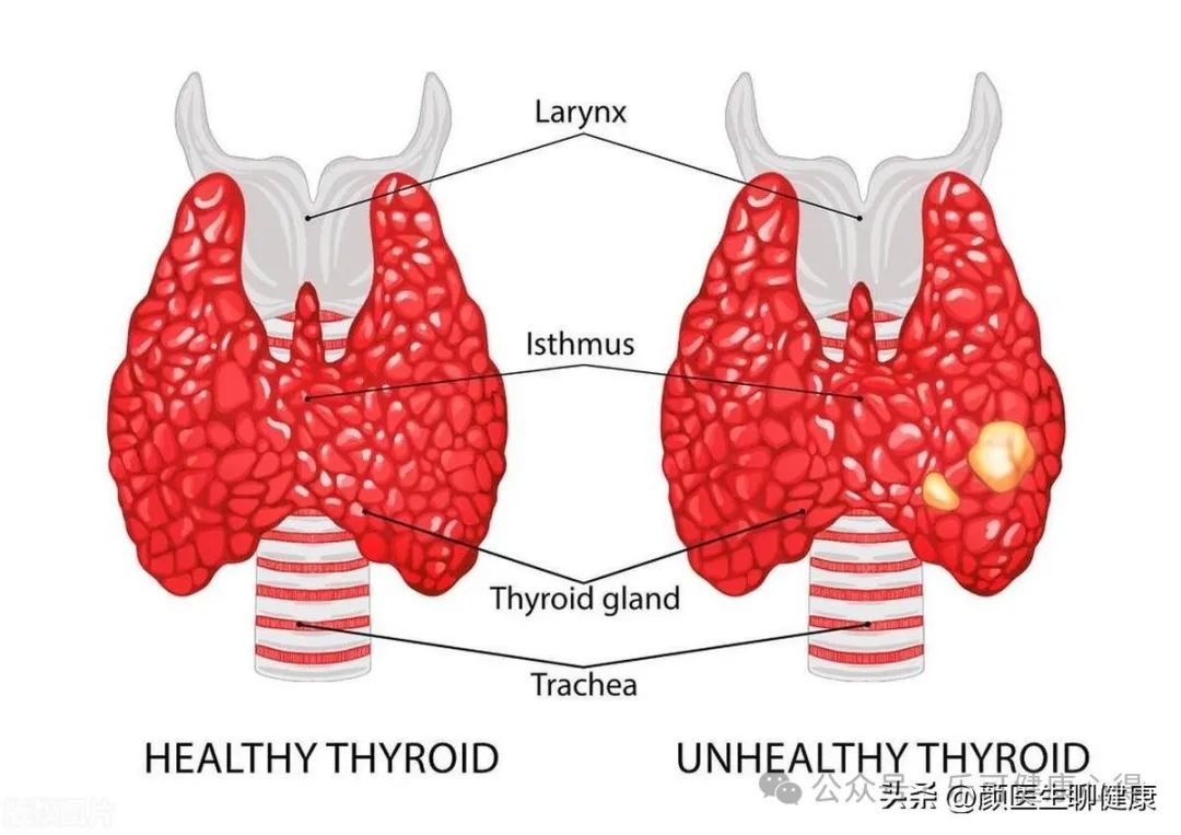 富硒水果的吃法有哪些呢（为什么富硒水果会好吃一些）-硒宝网