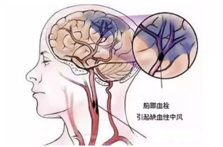 富硒的水果对身体的好坏（什么水果含富硒多）-硒宝网