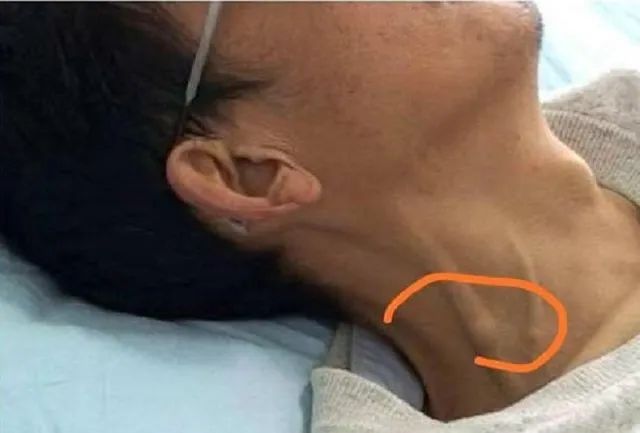 富硒的水果对身体的好坏（什么水果含富硒多）-硒宝网