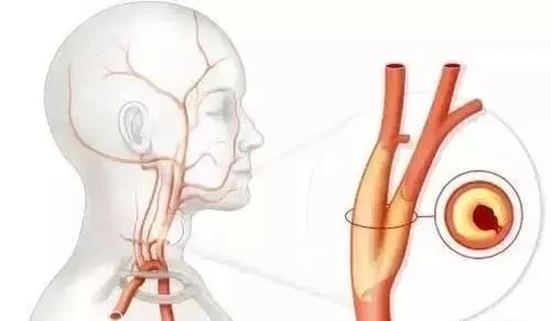 富硒的水果对身体的好坏（什么水果含富硒多）-硒宝网