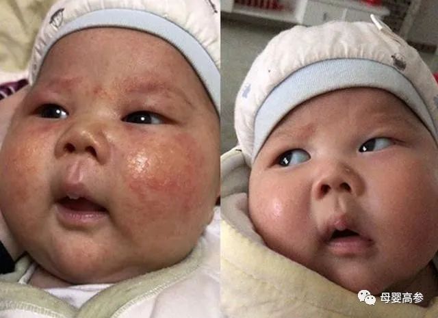 含锌硒的产品有什么危害（锌危害含产品硒有多少）-硒宝网