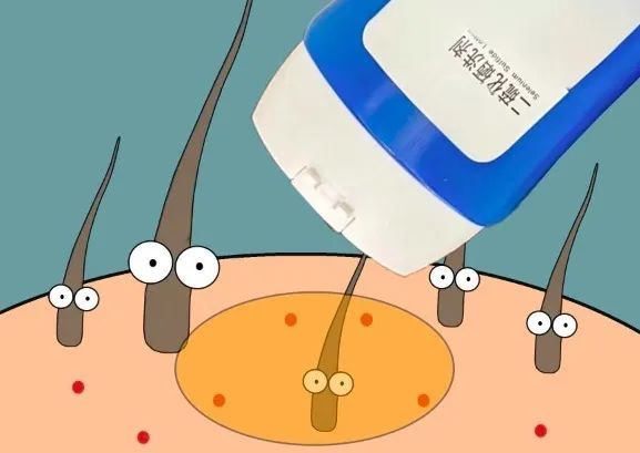 二硫化硒去屑产品有哪些(硫化去屑产品硒有什么作用)-硒宝网