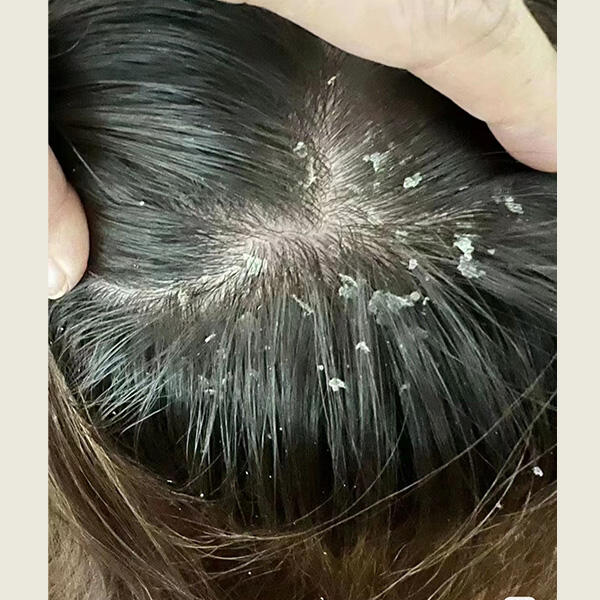 二硫化硒去屑产品有哪些(硫化去屑产品硒有哪些)-硒宝网