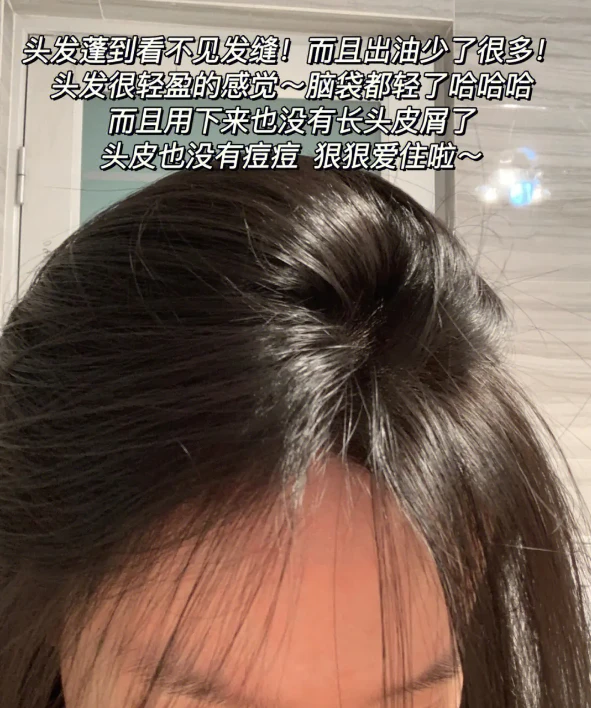 二硫化硒去屑产品有哪些(硫化去屑产品硒有哪些)-硒宝网