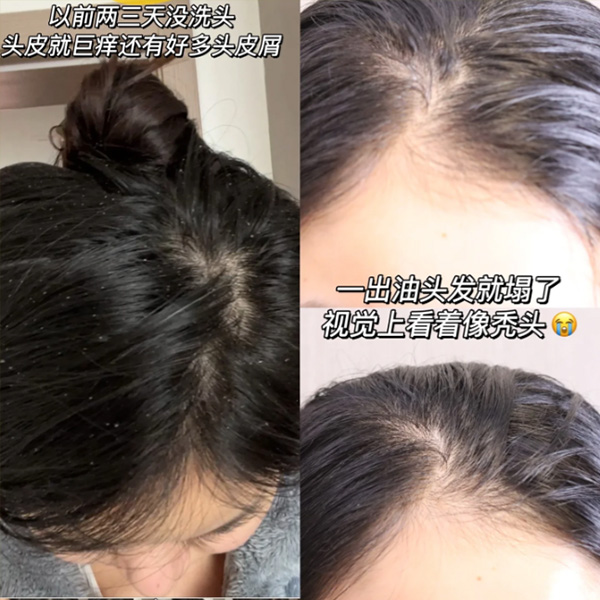 二硫化硒去屑产品有哪些（硫化去屑产品硒有害吗）-硒宝网