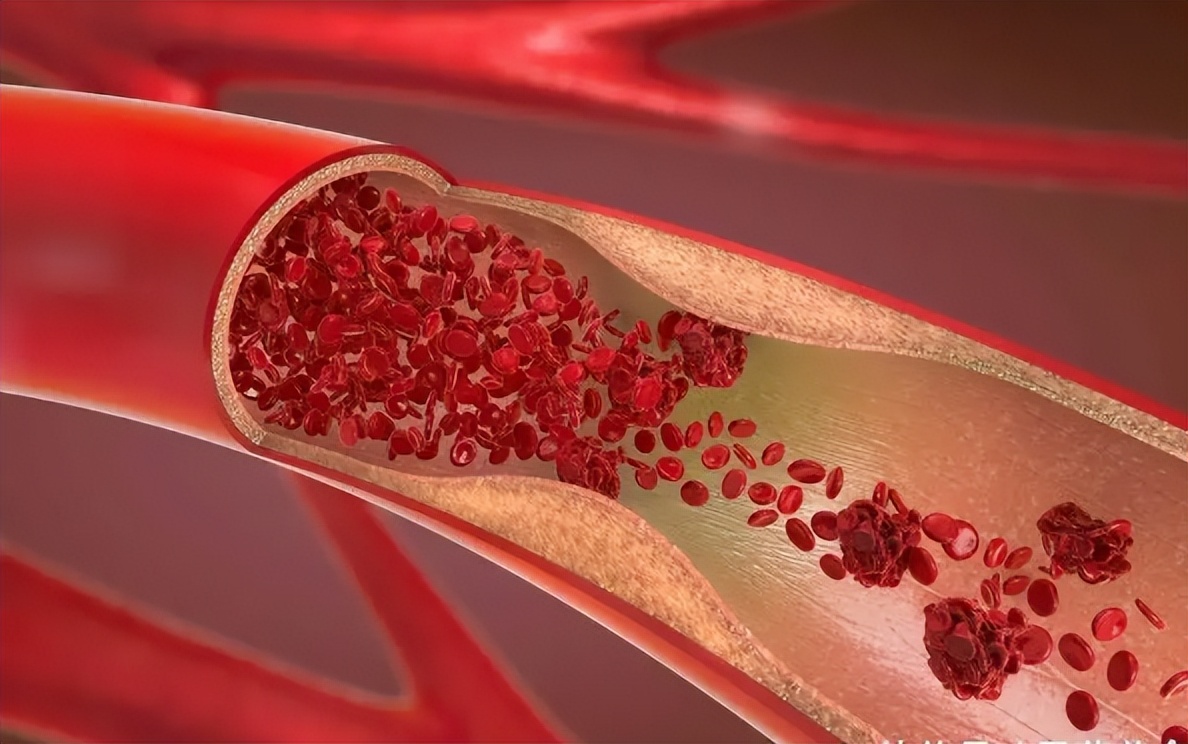 哪款硒产品好吸收一点呢(如何补硒d.吃高吉星蛋白硒好)-硒宝网