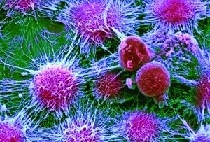 硒维康能治甲状腺结节吗（能治甲状腺结节硒维康的药）-硒宝网