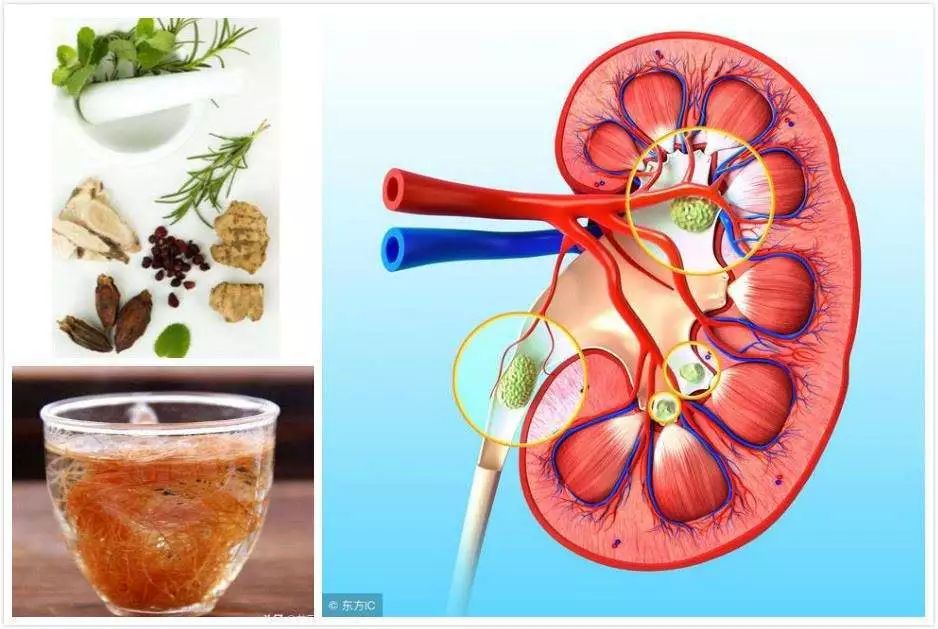 吃硒维康会导致肾结石吗(肾结石能喝富硒水吗)-硒宝网