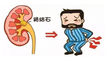 吃硒维康会导致肾结石吗(肾结石可以吃硒酵母片吗)-硒宝网