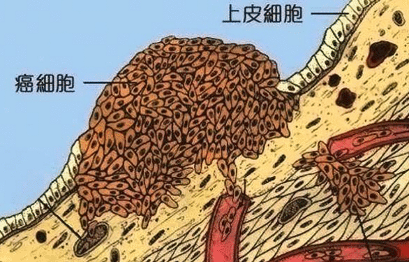 硒维康吃多了皮肤会黄吗（补硒导致皮肤黄染怎么办）-硒宝网