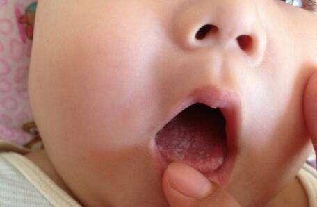 新稀宝锌硒宝片治疗什么（锌硒宝片新稀宝）-硒宝网