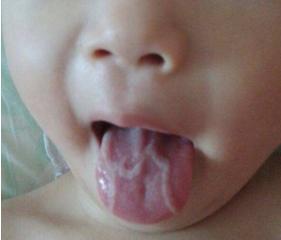 新稀宝锌硒宝片治疗什么（锌硒宝片新稀宝）-硒宝网