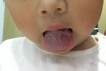 新稀宝锌硒宝片治疗什么（锌硒宝片新稀宝）-硒宝网