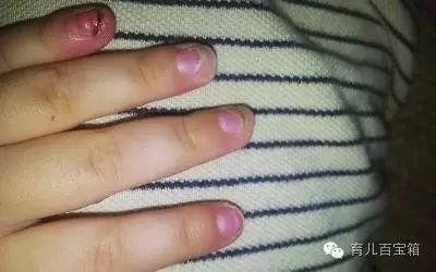 牡蛎和锌硒宝效果相同吗(牡蛎锌片怎么样)-硒宝网