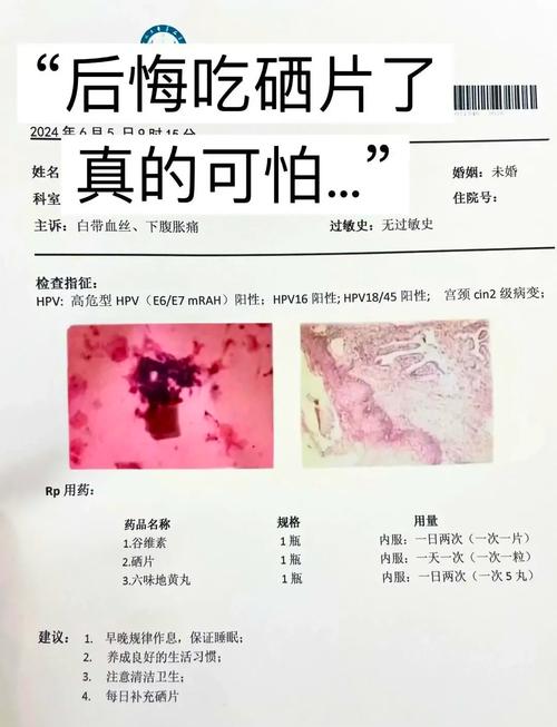 熬夜吃锌硒宝可以吗女性(锌硒片可以多吃吗)-硒宝网