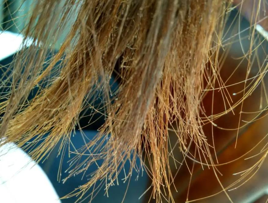 十二岁长白头发吃锌硒宝（锌对白头发的作用）-硒宝网