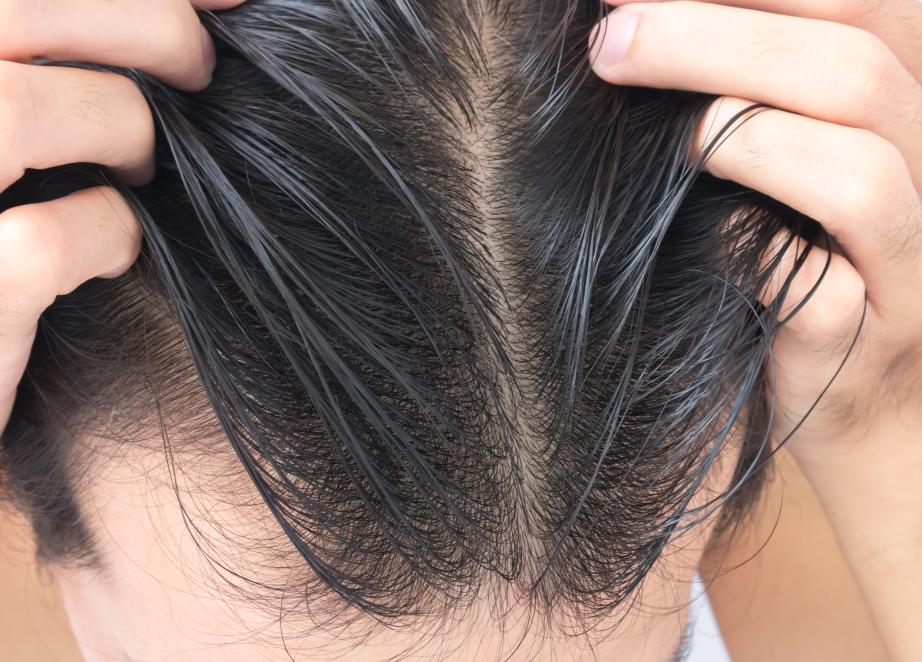 十二岁长白头发吃锌硒宝（锌对白头发的作用）-硒宝网