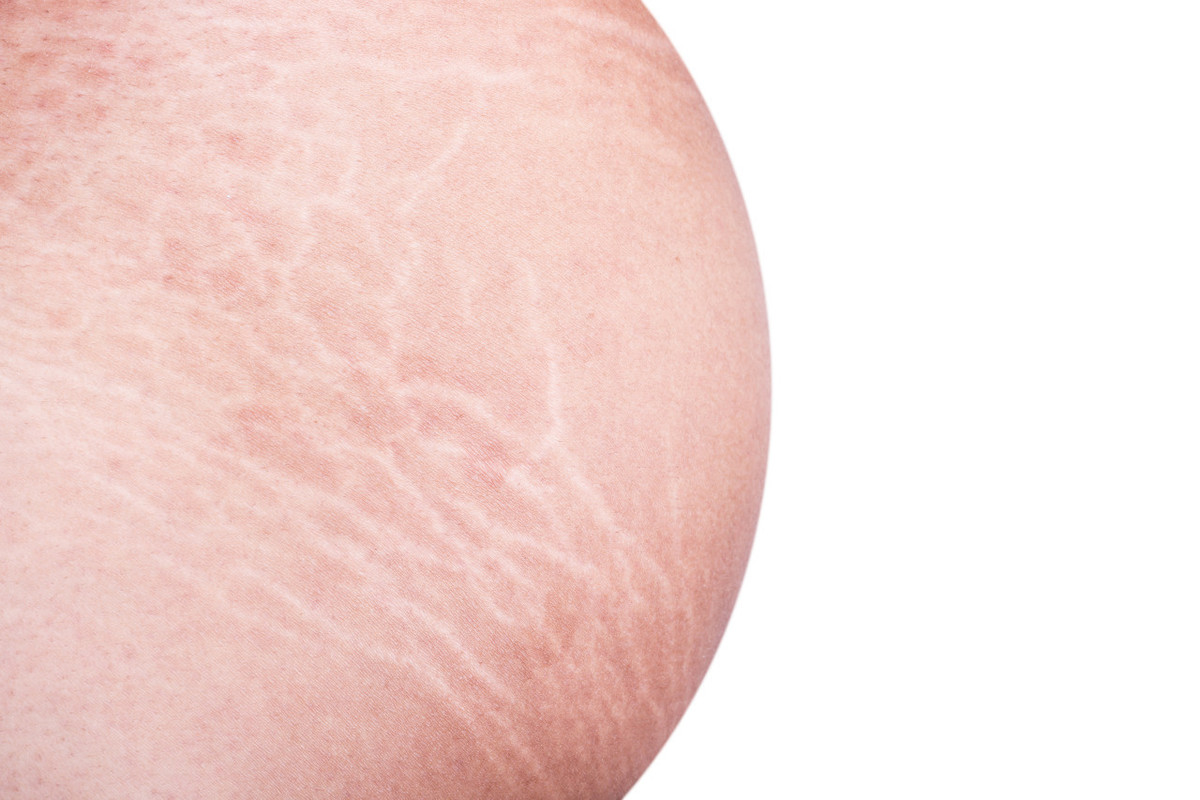 富硒胶原蛋白肽（富硒胶原蛋白肽口服液怎么样）-硒宝网