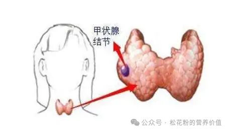 硒元素有什么好处（硒元素对人体好处）-硒宝网