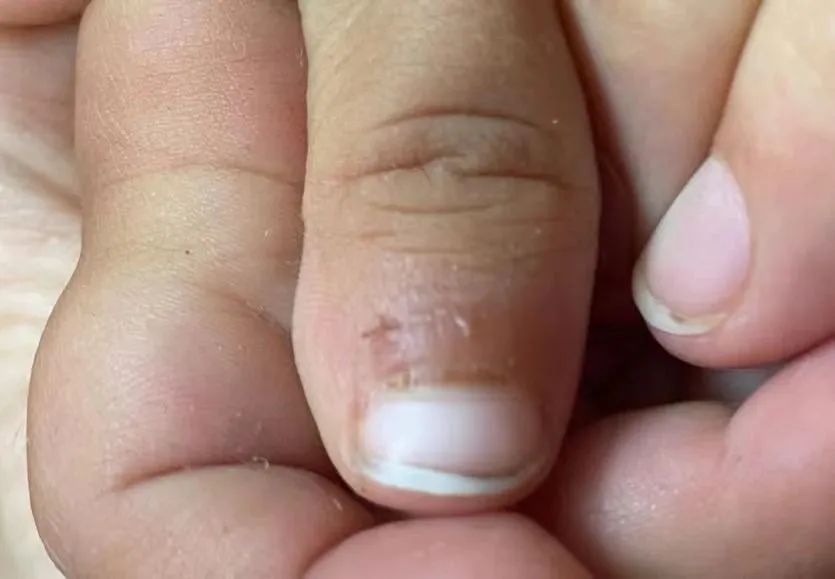 补硒食物排行榜(全球公认十大补硒的食物)-硒宝网