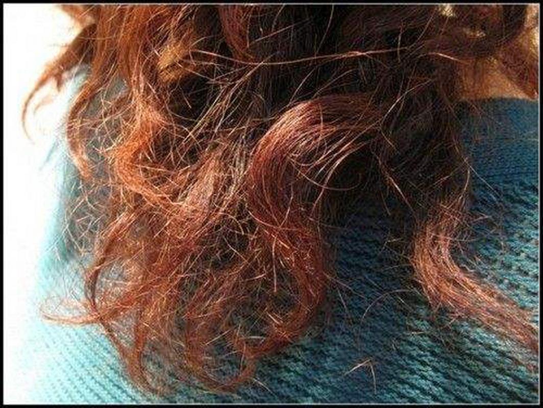 什么人要补硒(补硒很重要吗)-硒宝网