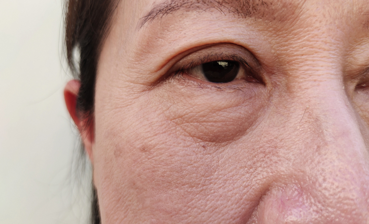 什么人要补硒(补硒很重要吗)-硒宝网