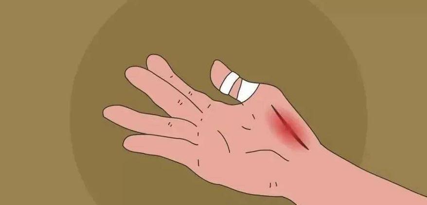 补硒可以治疗桥本甲状腺炎吗(桥本甲状腺炎可以补硒吗)-硒宝网