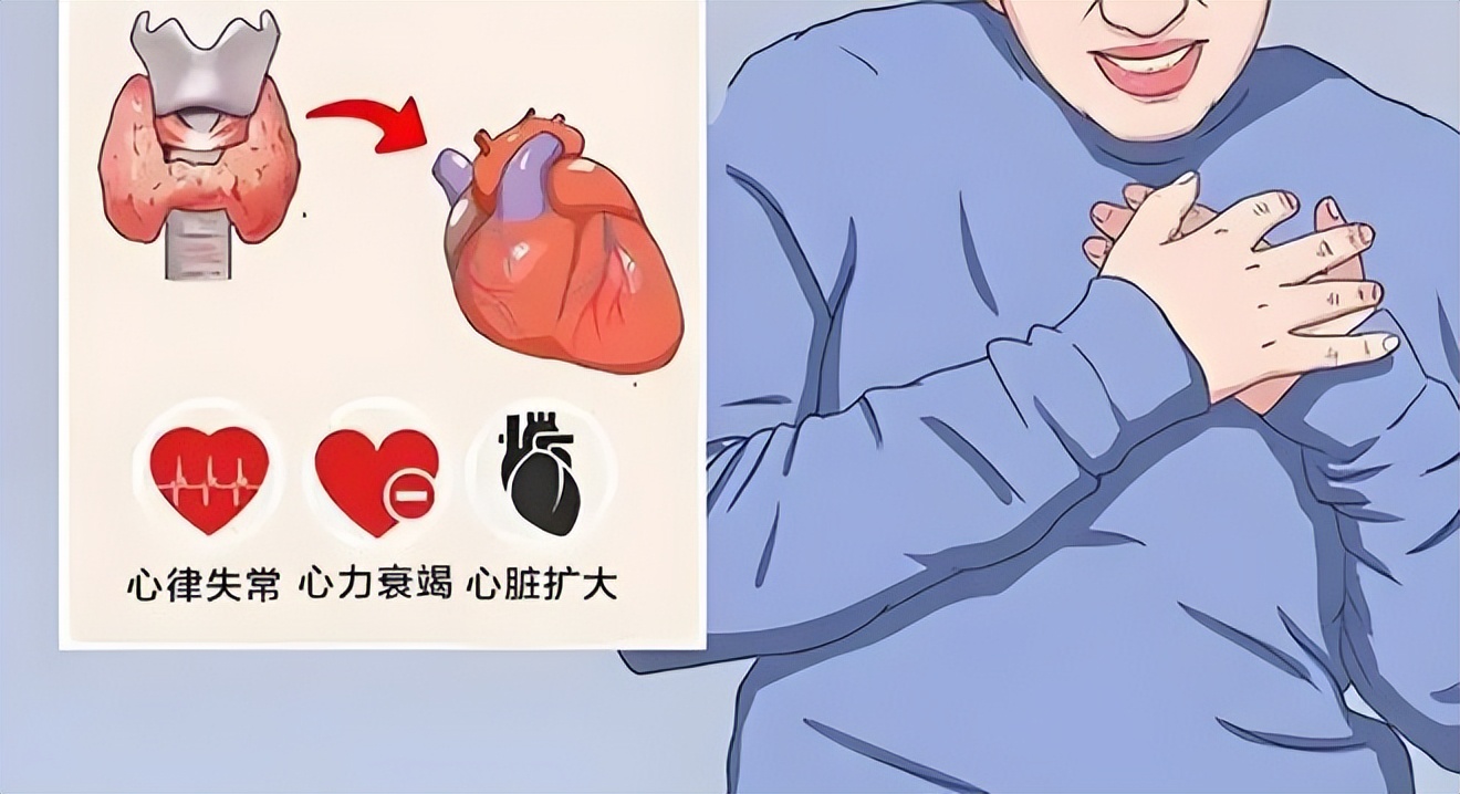 补硒可以治疗桥本甲状腺炎吗（桥本甲状腺炎吃补硒药吗）-硒宝网