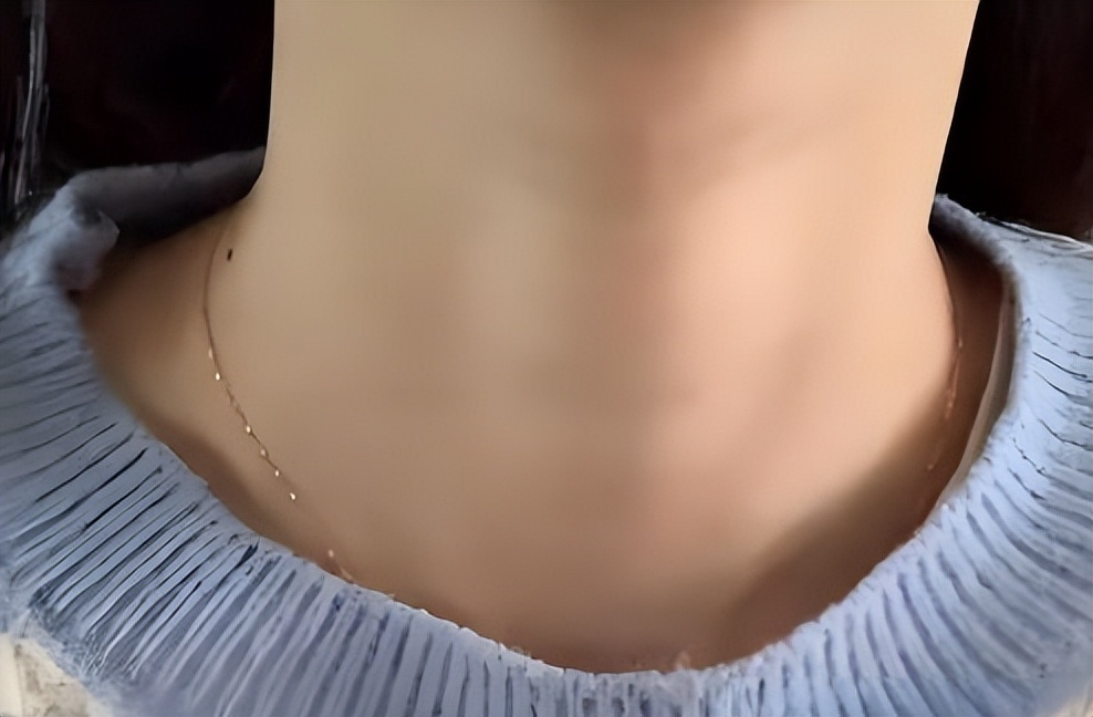 补硒可以治疗桥本甲状腺炎吗（桥本甲状腺炎吃补硒药吗）-硒宝网