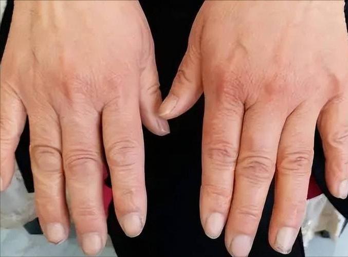 补硒需要注意什么(补硒需要吃什么东西)-硒宝网