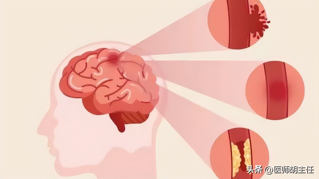 补硒有必要吗(补硒的必要性)-硒宝网