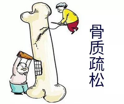 可贝力补钙效果好不好( 骨质疏松预防 )-硒宝网