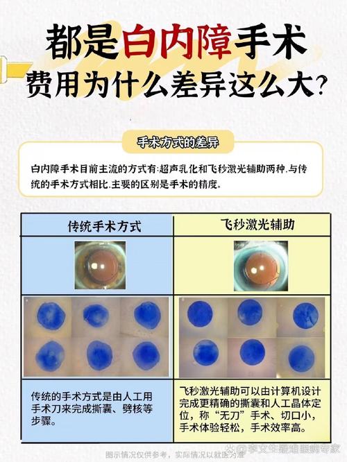 硒维康的价格（白内障手术价格）-硒宝网