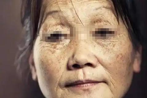 人体怎么补硒(硒元素补充方法)-硒宝网