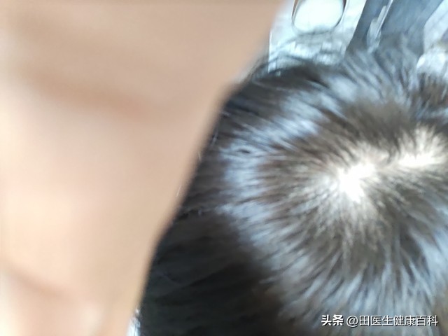 哪些人要补硒（硒缺乏与癌症风险）-硒宝网