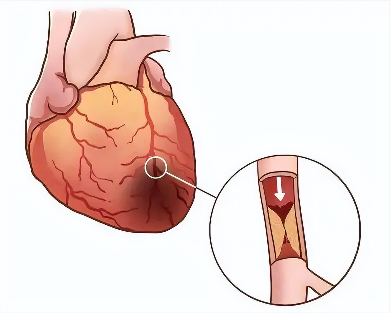 需要补硒人群(硒含量食物推荐)-硒宝网