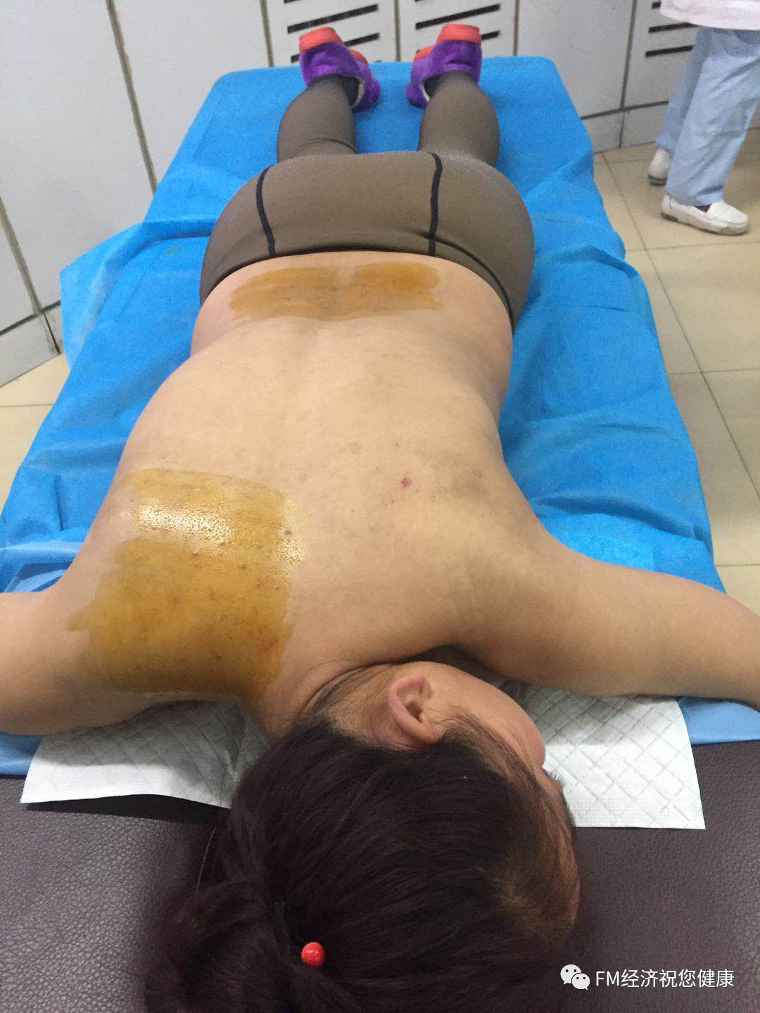 补硒治疗布病（布鲁菌病中医治疗）-硒宝网