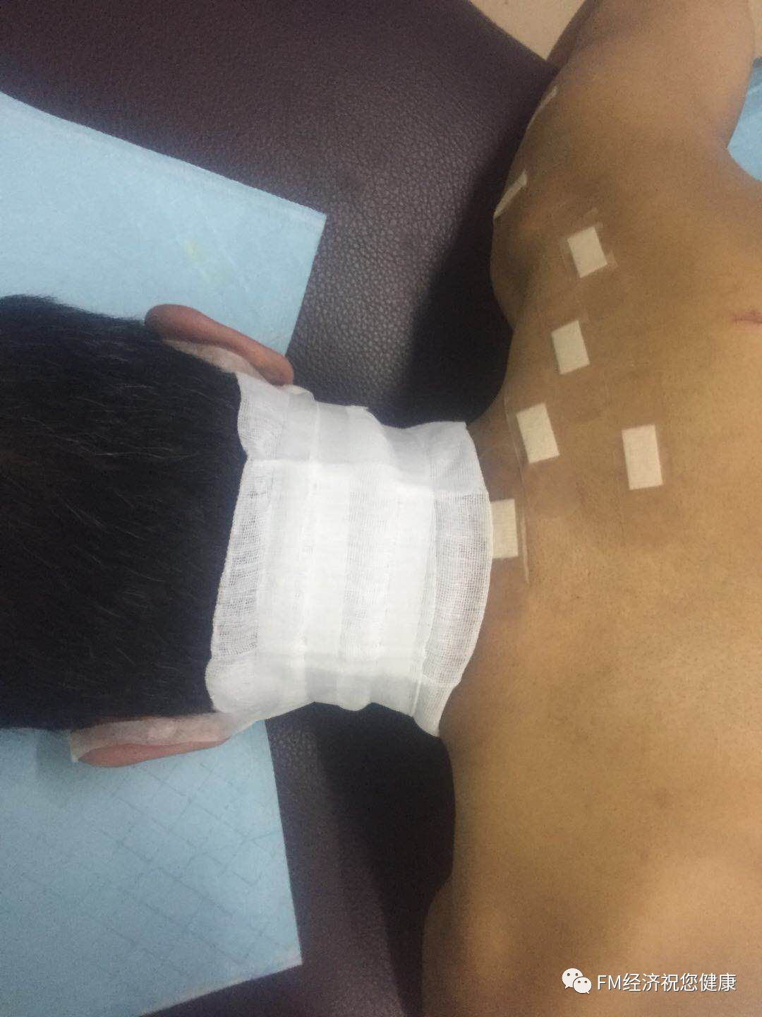 补硒治疗布?。ú悸尘≈幸街瘟疲?硒宝网