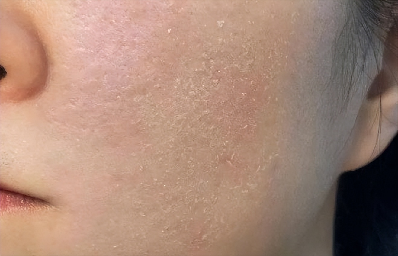 食物能补硒吗(硒与心脏病关系)-硒宝网