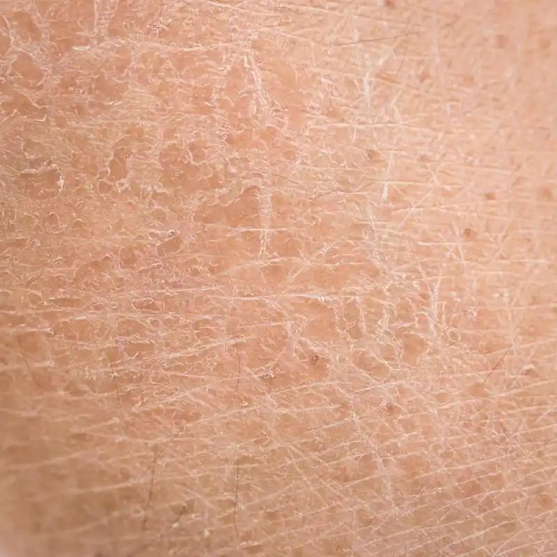 硒酵母补硒么（）-硒宝网