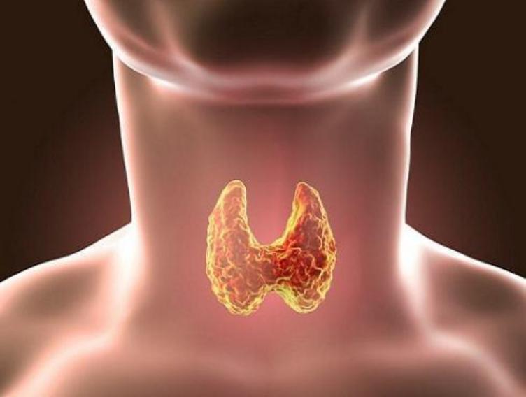 孕妇补硒补碘(无声甲状腺癌症状)-硒宝网