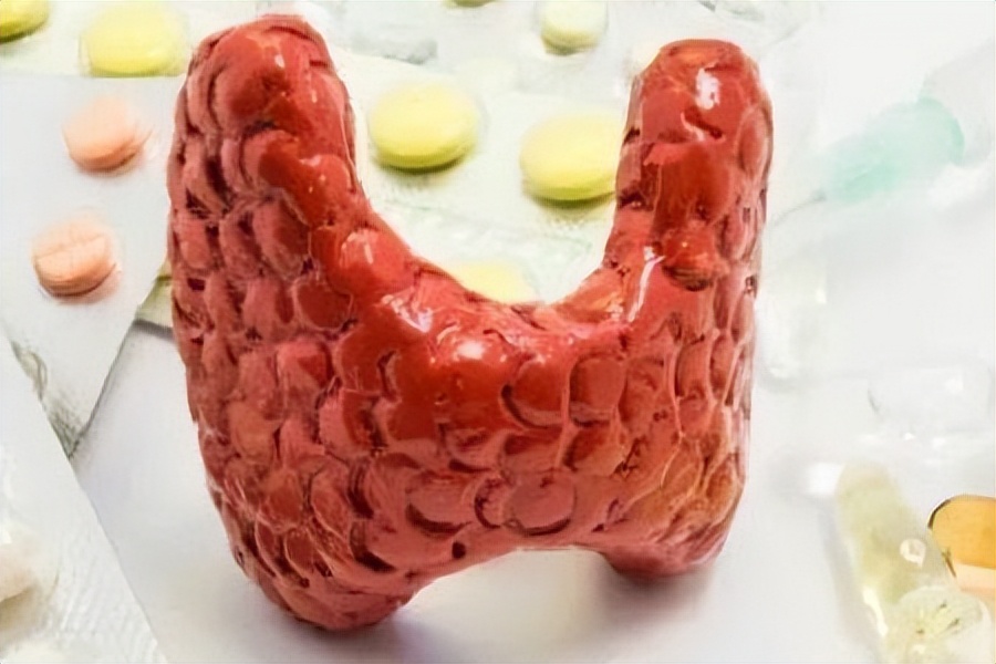 孕妇补硒补碘(无声甲状腺癌症状)-硒宝网