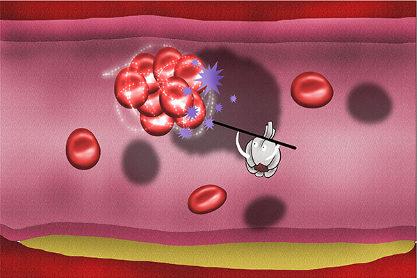 肝病补硒好吗(大蒜素与肝脏健康)-硒宝网